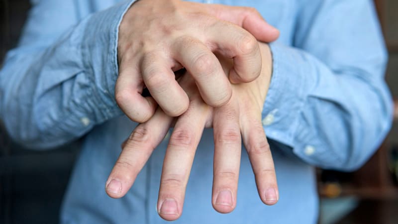 Odborníci varují před svrabem. Oblíbená destinace Čechů hlásí nárůst o 750 procent